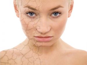 Làn da và sức khỏe bị ảnh hưởng bởi độc tố
