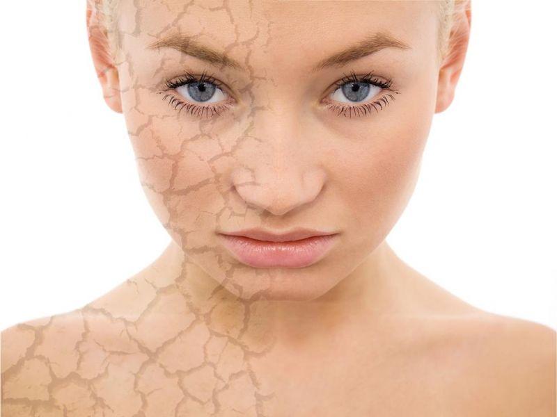 Làn da và sức khỏe bị ảnh hưởng bởi độc tố